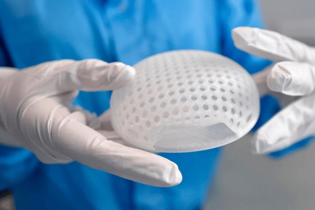 Lattice Medical breast implant 3D printed prototype