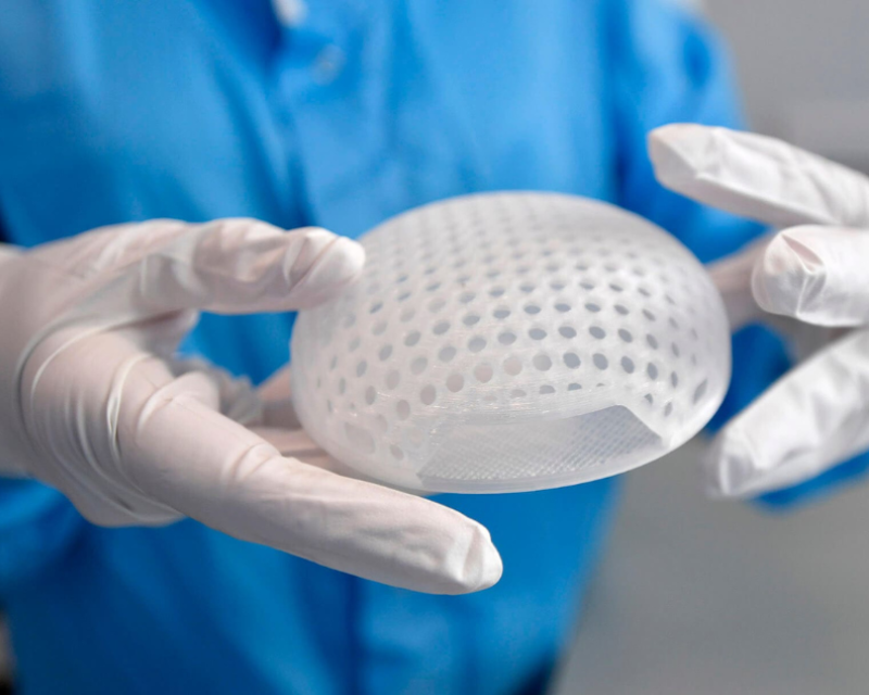 A Lattice Medical lab researcher holding a 3D printed breast implant.